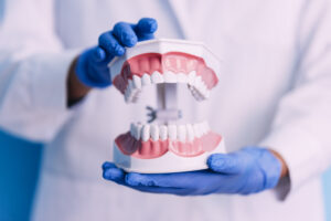 Modelo dental usado en la Clínica Elena Queral en Castellón para explicar tratamientos de implantes dentales.