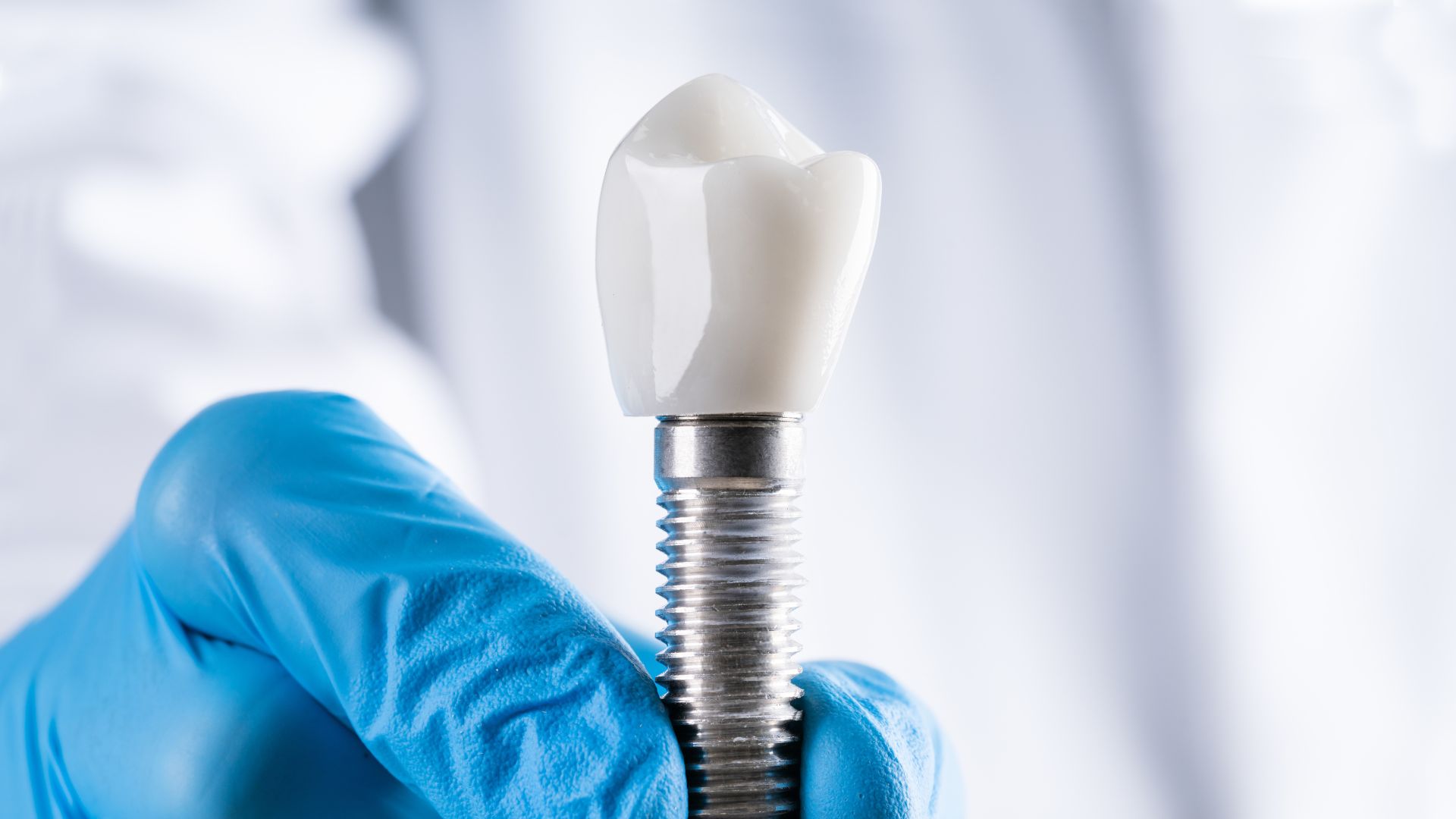 ¿Cuánto dura un implante dental? Cifras reales y factores