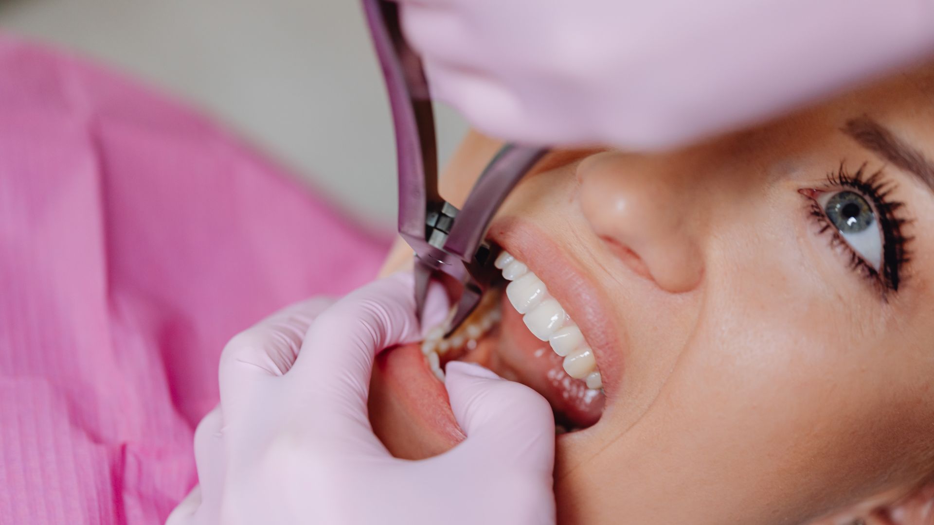 Empaste o endodoncia: cómo se decide cuál necesita tu diente
